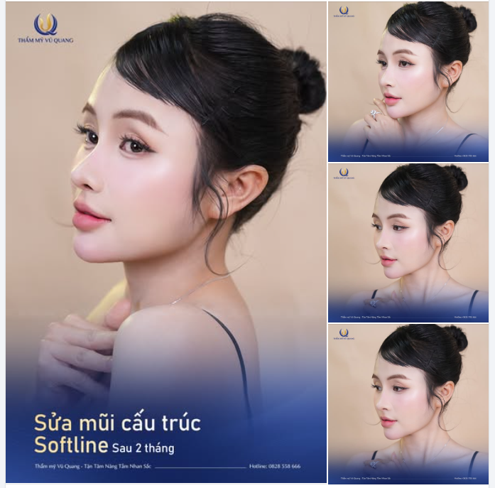 TẾT 2026: ĐỔI DÁNG MŨI - CẢI VẬN SỐ!