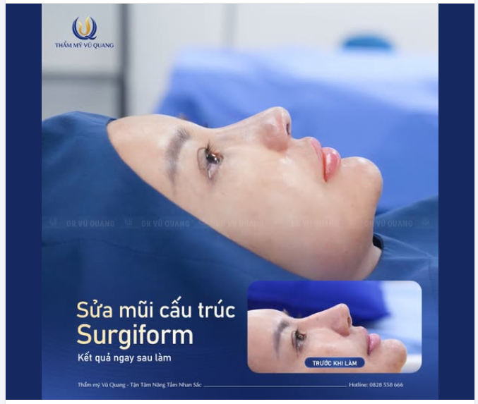 TẠM BIỆT NỖI LO MŨI CO RÚT – MÀN “LỘT XÁC” ĐÓN TẾT CỦA CÔ GÁI 9X
