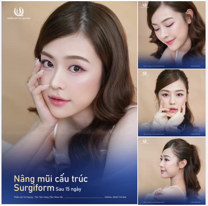 ĐẸP KỊP TẾT– MŨI SOFTLINE 15 NGÀY VÀO PHOM CỰC ĐỈNH