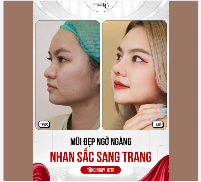 MŨI ĐẸP NGỠ NGÀNG - NHAN SẮC SANG TRANG