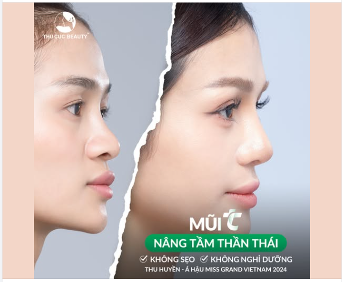 Á hậu 2 Miss Grand Vietnam Vũ Thu Hiền lựa chọn Mũi TC