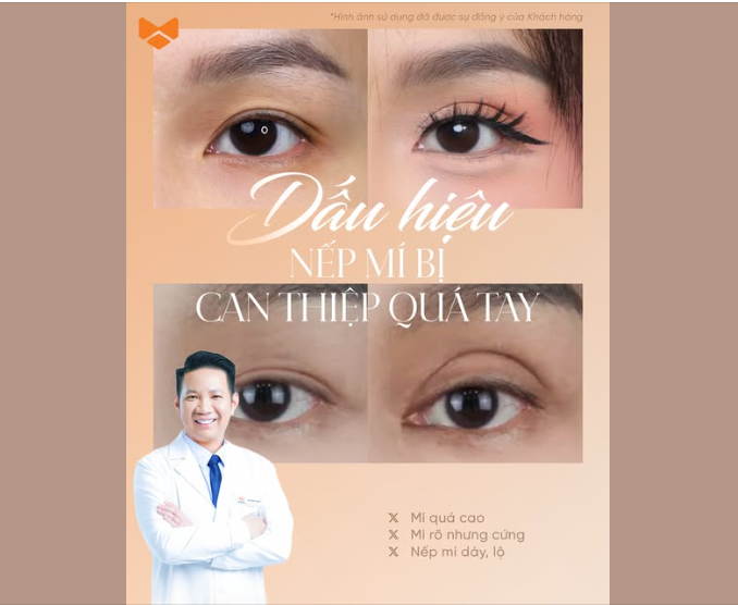 NHỮNG DẤU HIỆU CHO THẤY CA MÍ MẮT ĐÃ CAN THIỆP QUÁ TAY