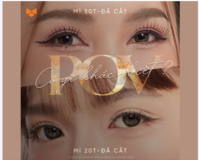 Sau 30 tuổi, cắt mí không còn là câu chuyện “tạo nếp” đơn thuần.