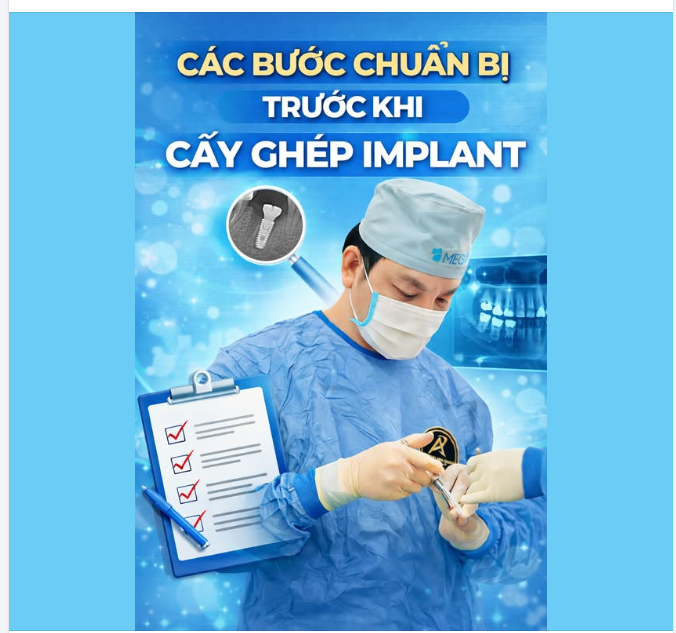 Các bước chuẩn bị trước khi cấy ghép Implant
