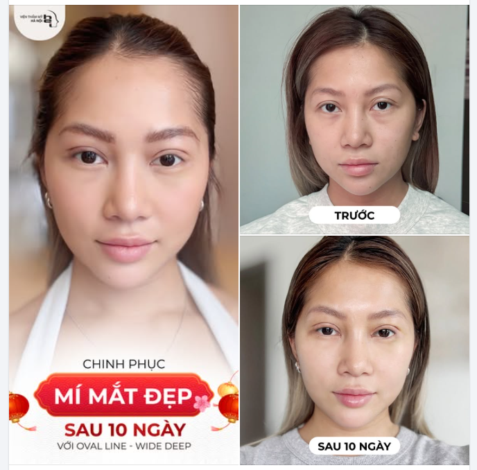 Cùng bộ đôi Oval Line và Oval Line Wide Deep chạm nhẹ mí xinh