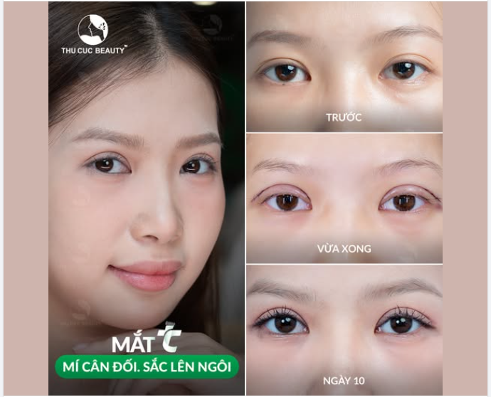 Mí rõ nếp nhưng vẫn giữ trọn nét tự nhiên vốn có