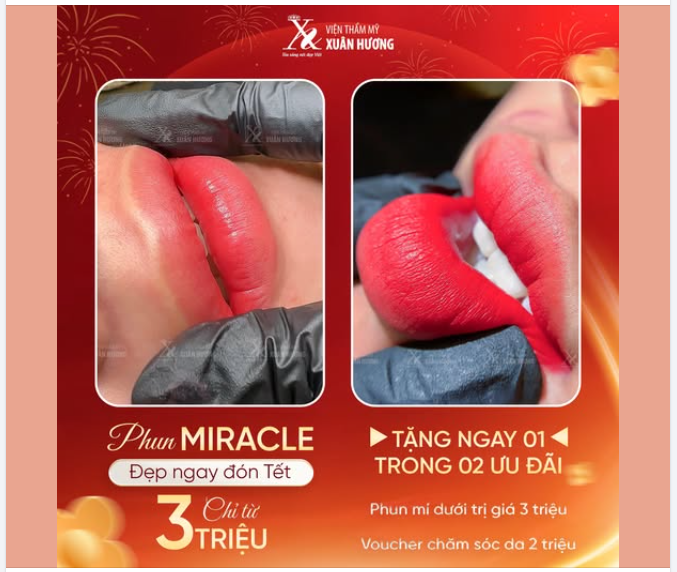 PHUN MIRACLE ĐẸP NGAY ĐÓN TẾT - CHỈ TỪ 3 TRIỆU