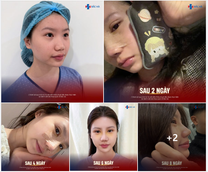 10 NGÀY ĐỦ ĐỂ THAY ĐỔI CẢ THẦN THÁI GƯƠNG MẶT