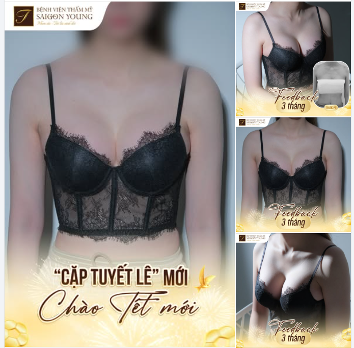 KHÔNG THUA CUỘC TRƯỚC “TRỜI SINH”  CÔ GÁI 21 TUỔI SỞ HỮU CẶP TUYẾT LÊ SIÊU MỌNG VỚI BÍ QUYẾT HOÀN HẢO