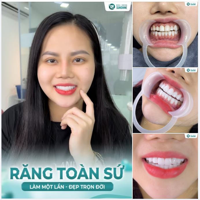 VÌ SAO NHIỀU NGƯỜI LÀM RĂNG CHỈ… 1 LẦN DUY NHẤT?