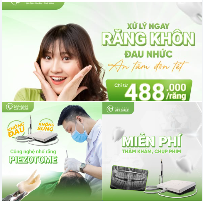 Biết là bận rồi nhưng mà để ý em RĂNG KHÔN một tí. Việt Smile đang ưu đãi nhổ răng khôn CHỈ 488k GIÁ CHƯA TỪNG CÓ