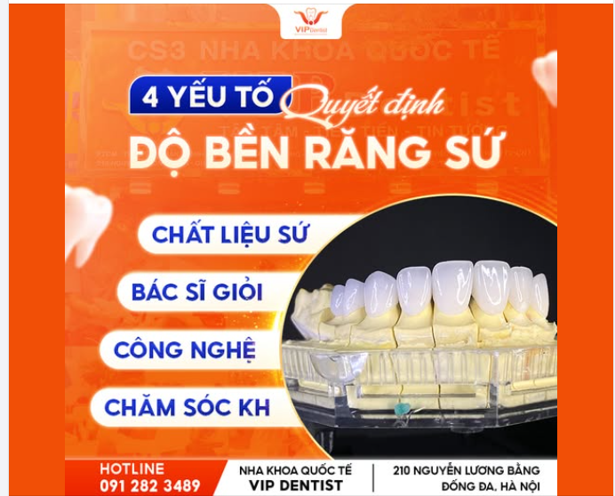 TOP 4 YẾU TỐ QUYẾT ĐỊNH ĐỘ BỀN RĂNG SỨ