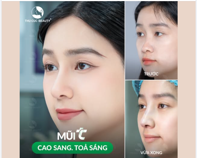 Bạn nghĩ sao về việc sở hữu dáng mũi chuẩn tỷ lệ vàng?