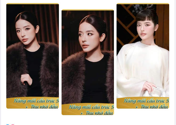 Nâng mũi cấu trúc kết hợp Thu nhỏ đầu mũi – Giải pháp “nâng cấp toàn diện” cho dáng mũi đẹp chuẩn tỉ lệ vàng sau 5 năm nhìn lại