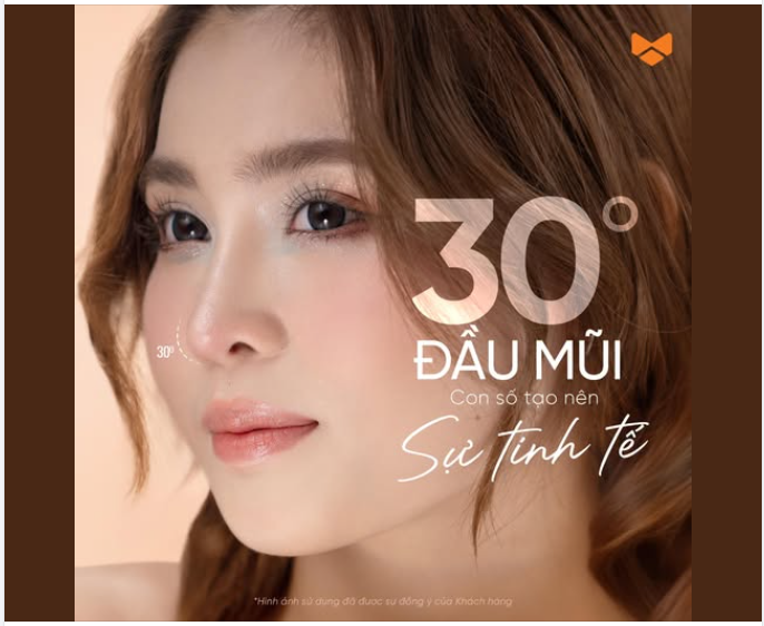 30° ĐẦU MŨI – GÓC NHỎ TẠO NÊN SỰ TINH TẾ