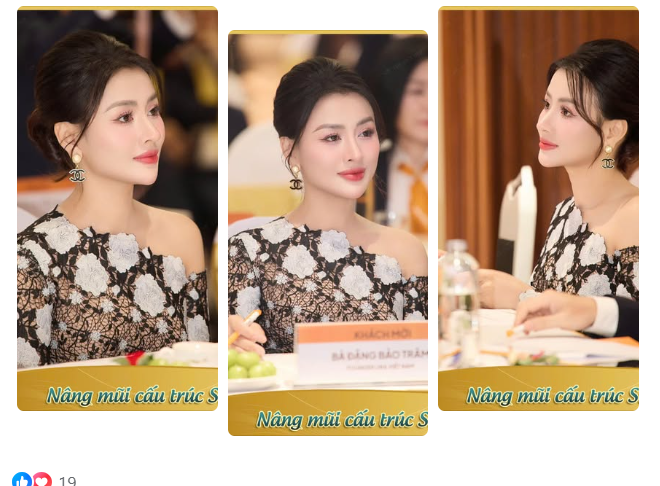 Thần thái “gây mê” của Cô giáo Đặng Bảo Trâm sau 5 năm nâng mũi Barbie-line tại Thế Giới Đẹp