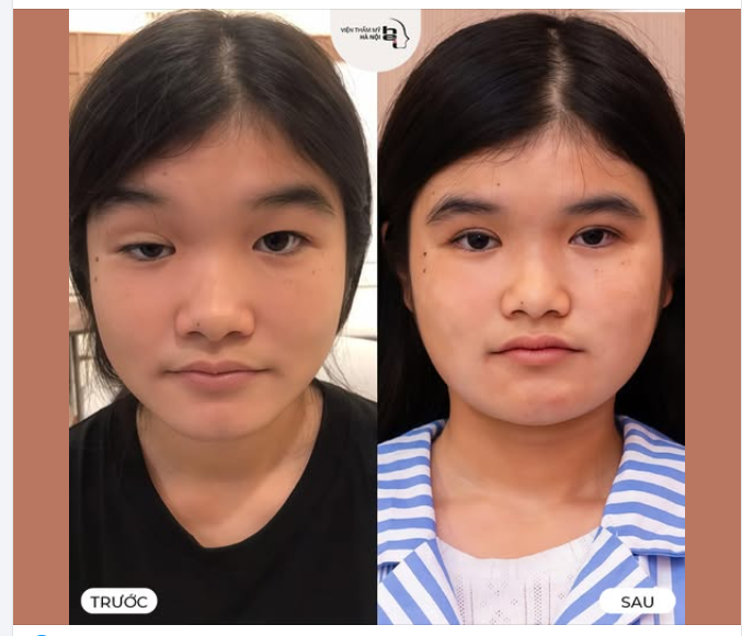 KHÔNG PHẢI LÚC NÀO SỤP MÍ CŨNG LÀ DO BUỒN NGỦ…