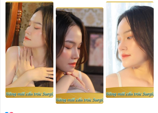 Khác với trước đây nhiều người chuộng mũi cao Tây thì ngược lại form, dáng mũi tự nhiên, vừa phải phù hợp, hài hòa lại trở thành xu hướng.