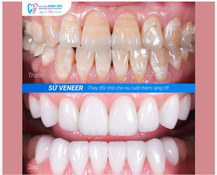 Một thay đổi rất nhỏ… nhưng đủ để bạn mỉm cười tự tin mỗi ngày.