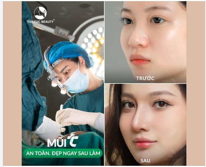 Sống mũi tẹt, cánh mũi to bè Chỉ 1 chi tiết phá hỏng cả khuôn mặt