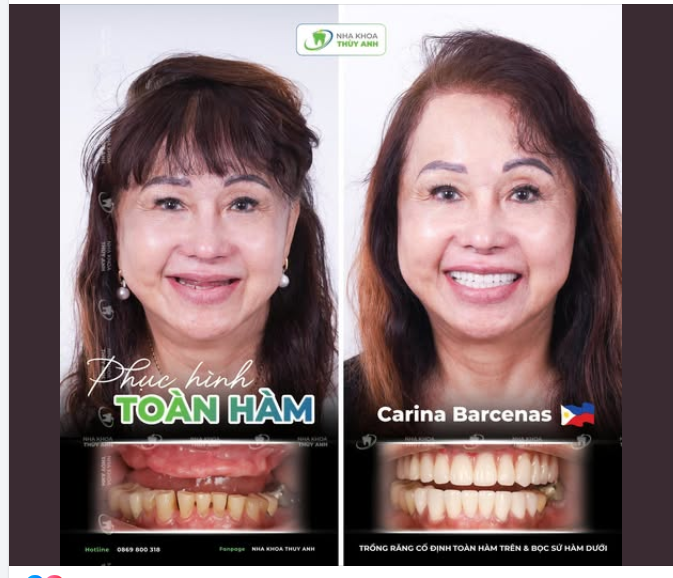 TÁI SINH NỤ CƯỜI – PHỤC HỒI CHỨC NĂNG TOÀN DIỆN