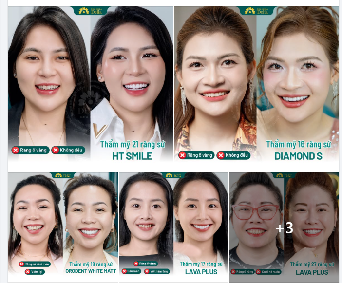 CƯỜI ĐẸP HƠN TỰ TIN VUI ĐÓN TẾT