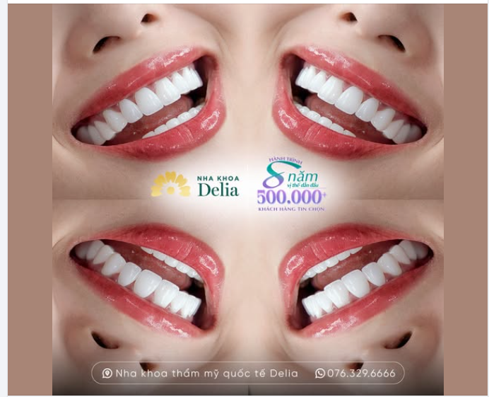 Top những việc phải làm trước Tết - Top 1: Ghé Delia làm răng sứ