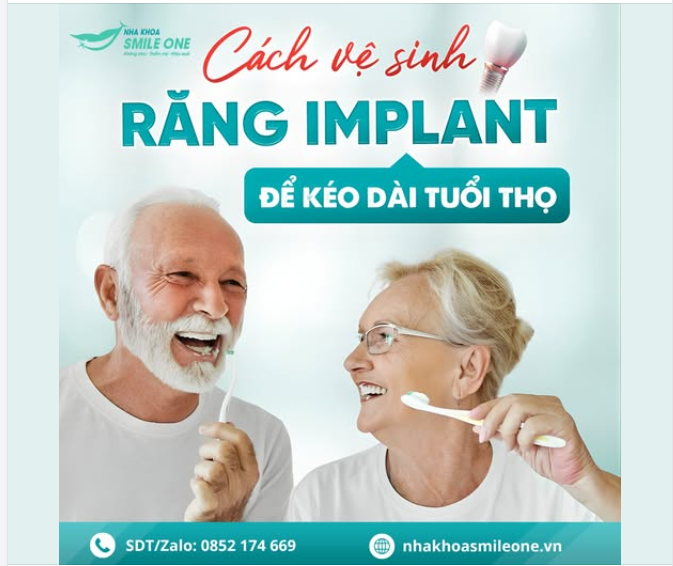 CÁCH VỆ SINH RĂNG IMPLANT: CHUẨN Y KHOA – BỀN ĐẸP TRỌN ĐỜI