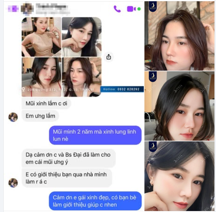 2 NĂM MỘT CHẶNG ĐƯỜNG – MŨI VẪN XINH, FORM VẪN CHUẨN NHƯ NGÀY ĐẦU