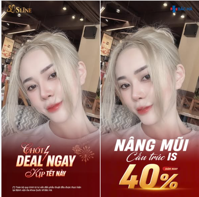 MŨI ĐẸP LÀ THAY ĐỔI CẢ GƯƠNG MẶT…  Không phải cứ nâng cao là đẹp.