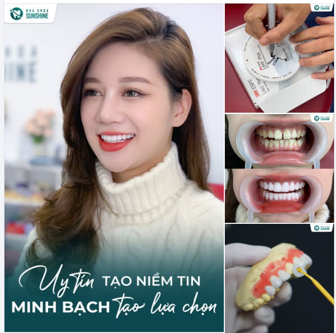 VÌ SAO GIỮA HÀNG NGÀN NHA KHOA, KHÁCH HÀNG VẪN CHỌN SUNSHINE?