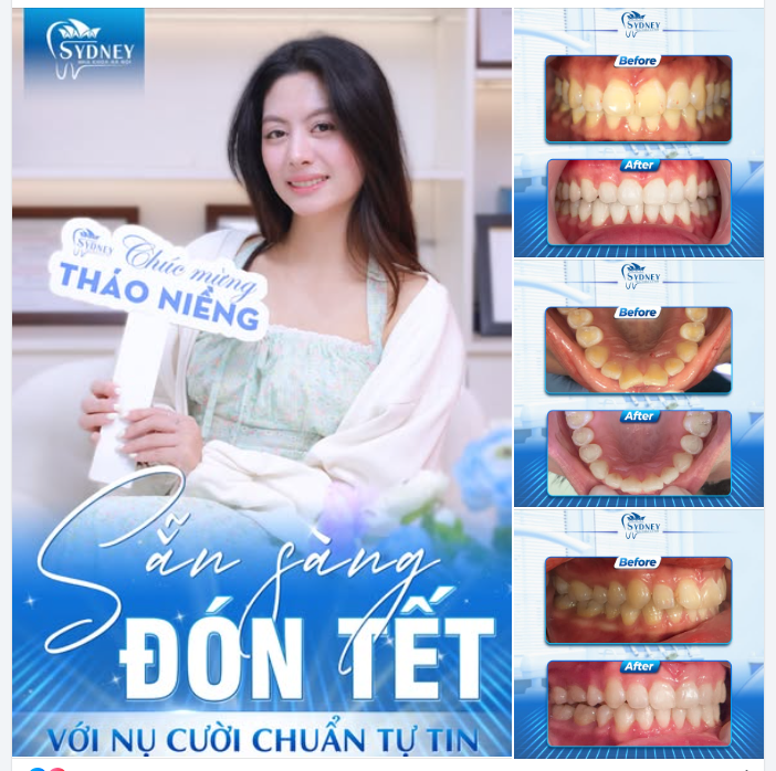 SẴN SÀNG ĐÓN TẾT VỚI NỤ CƯỜI CHUẨN TỰ TIN