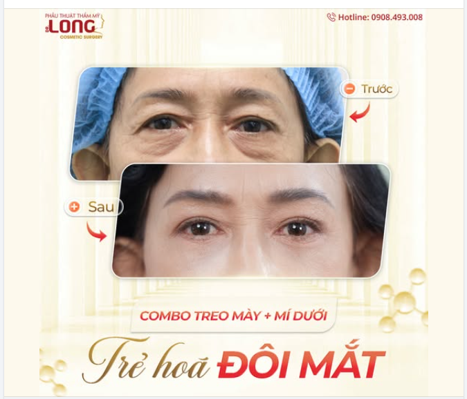 ĐỔI LÃO HÓA LẤY THANH XUÂN