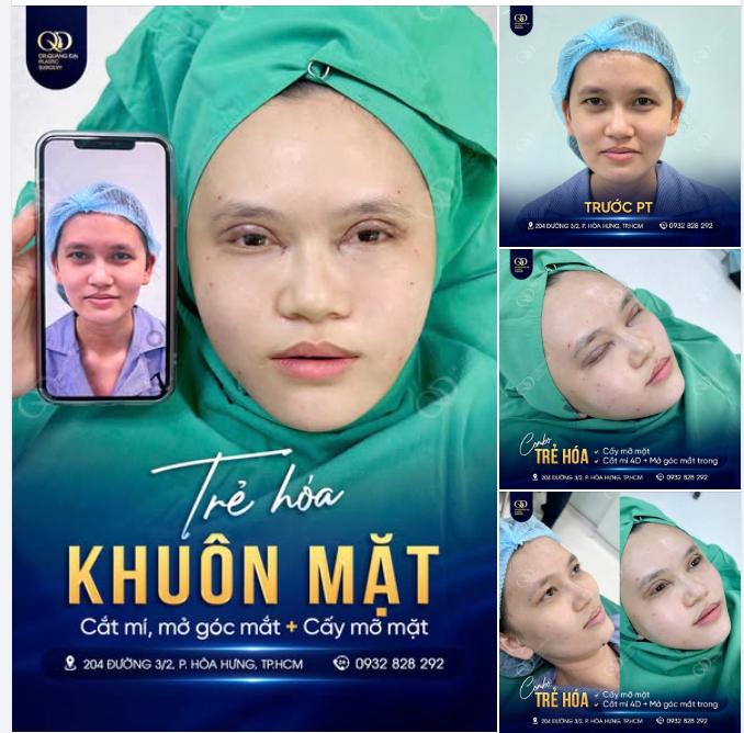 CÔNG THỨC "HACK TUỔI" ĐỈNH CAO: MẮT TO TRÒN + MẶT ĐẦY ĐẶN = TRẺ RA 10 TUỔI