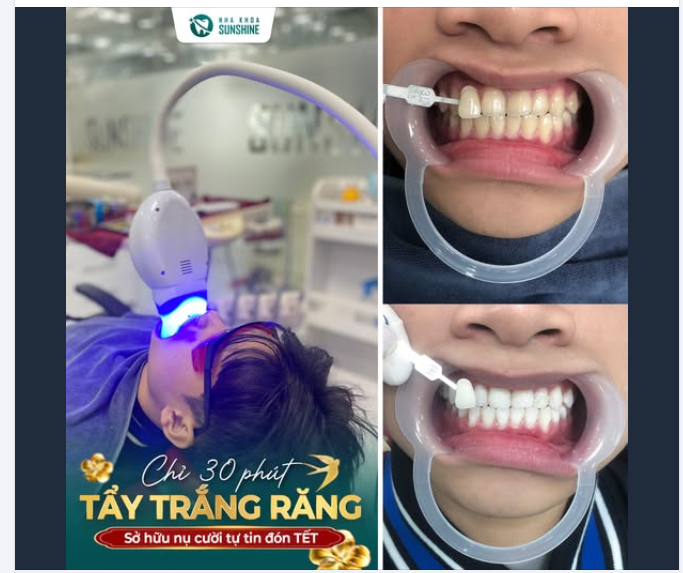 CẬN TẾT – AI CŨNG MUỐN CƯỜI ĐẸP, TỰ TIN