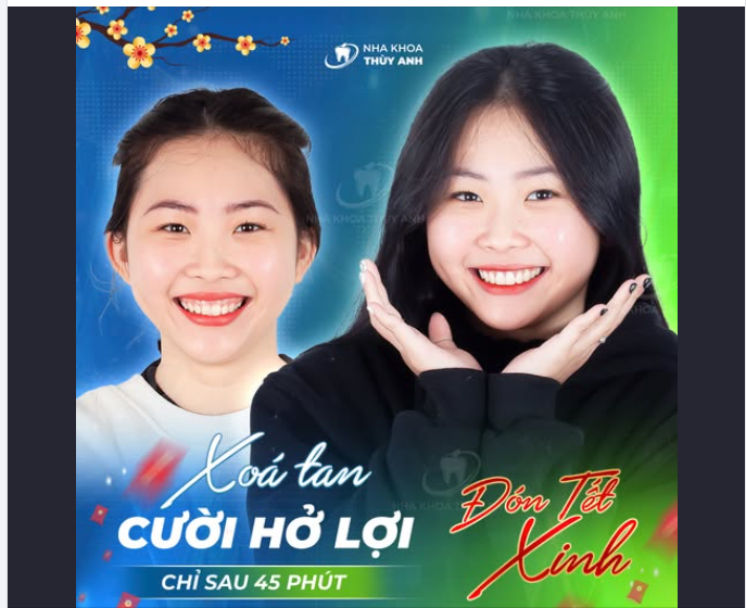 HÀ “NAIL” NỤ CƯỜI RẠNG RỠ CHÀO TẾT – TẠM BIỆT CƯỜI HỞ LỢI CHỈ SAU 45 PHÚT