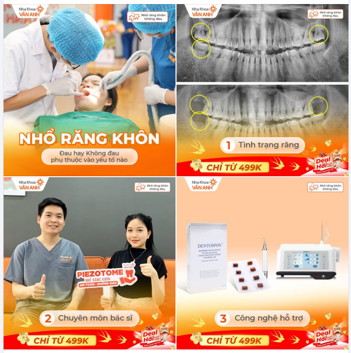 VÌ SAO CÓ NGƯỜI NHỔ RĂNG KHÔN RẤT NHẸ, CÓ NGƯỜI LẠI ĐAU NHIỀU?