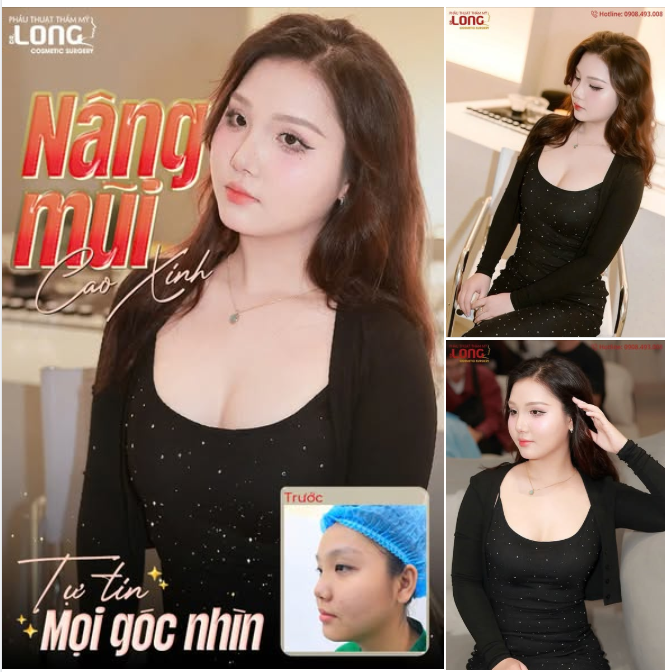 AIIII….MŨI XINH KHÔNGGGGG ?  Dáng mũi cao sang vận may ngập tràn đón mừng xuân sang