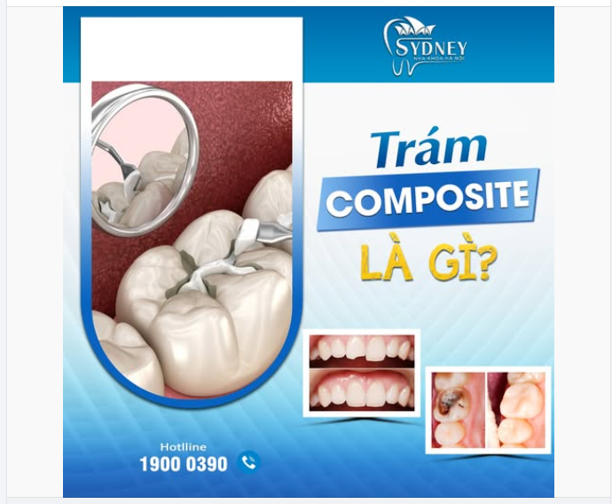 TRÁM COMPOSITE LÀ GÌ?