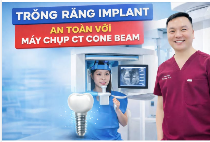 Trồng Răng Implant An Toàn Với Máy Chụp Ct Cone Beam