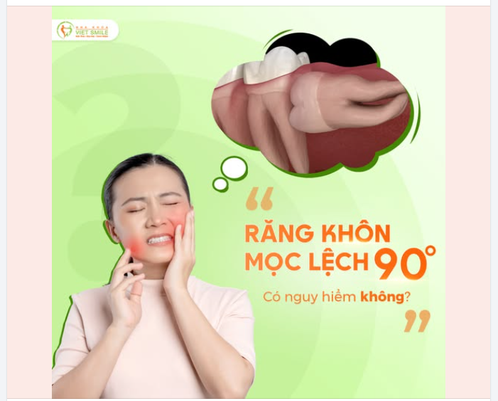 TẠI SAO RĂNG KHÔN THƯỜNG MỌC LỆCH, MỌC CHEN CHÚC?