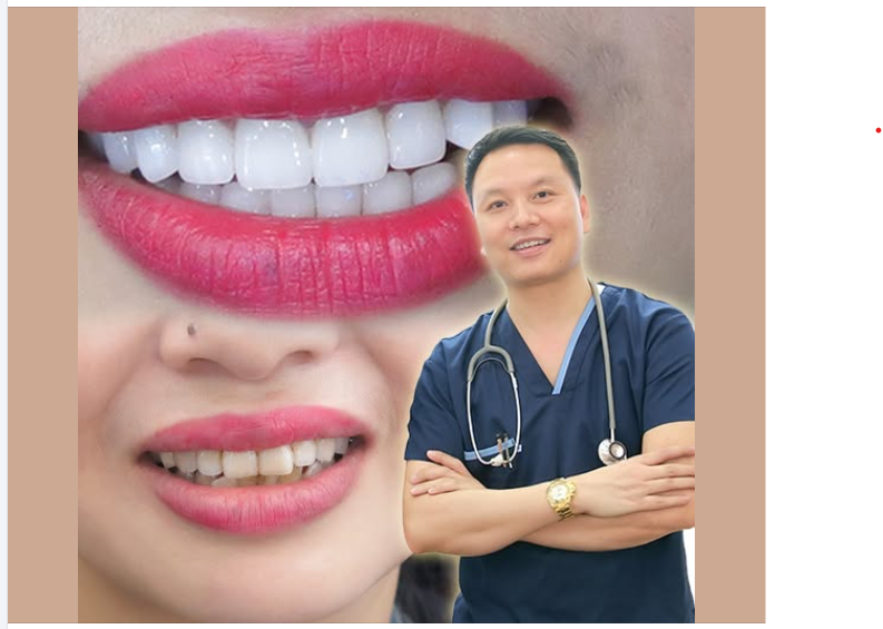 Những lưu ý sau khi làm răng sứ thẩm mỹ