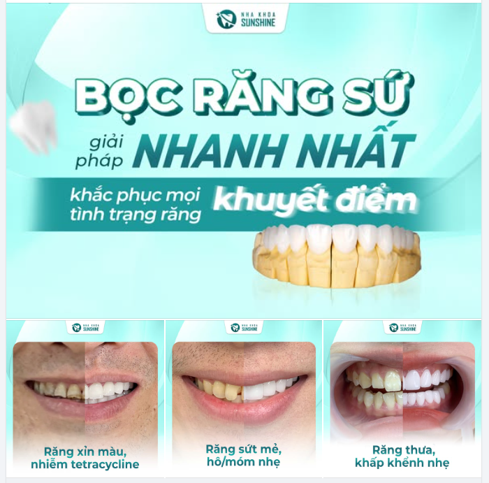 CHỈ CÒN HƠN 1 THÁNG NỮA ĐẾN TẾT – ĐỪNG ĐỂ NỤ CƯỜI LÀ ĐIỀU KHIẾN BẠN NGẠI NGÙNG
