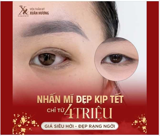 CẬN TẾT RỒI THỜI ĐIỂM NHẤN MÍ - NHANH TAY CHỚP NGAY DEAL HOT