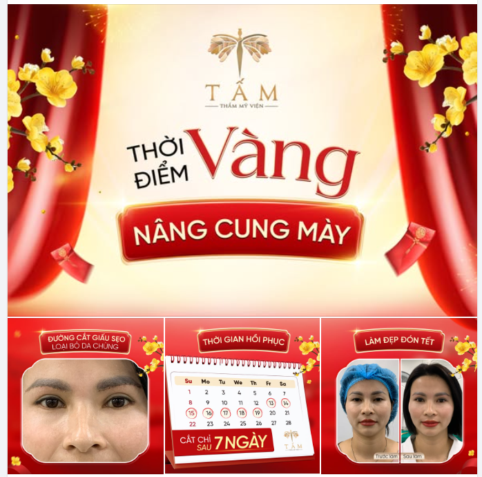 NÂNG CUNG MÀY: 7 ngày là tự tin đón TẾT!