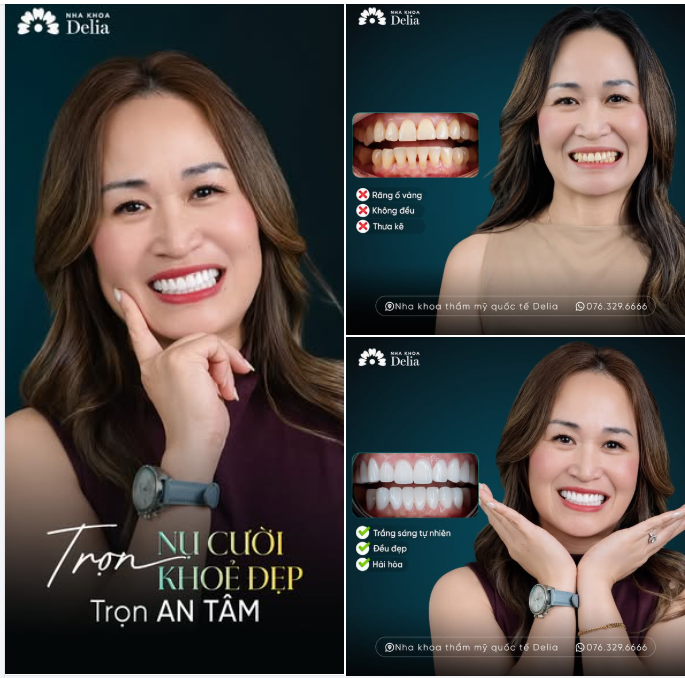 NỤ CƯỜI KHỎE ĐẸP - AN TÂM ĐÓN TẾT BÍNH NGỌ