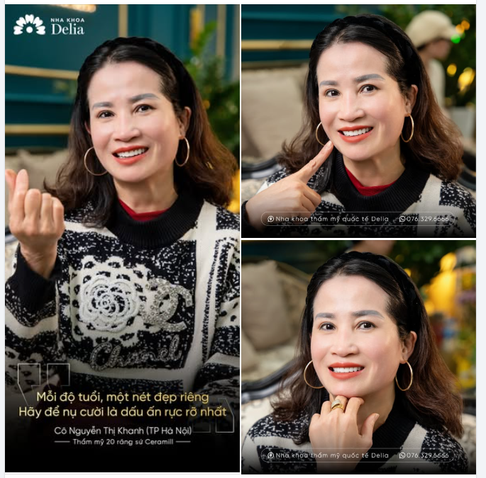 Ở tuổi U60, cô Nguyễn Khanh tìm đến giải pháp làm răng sứ không chỉ để đẹp hơn mà còn có một mong muốn rất giản dị: