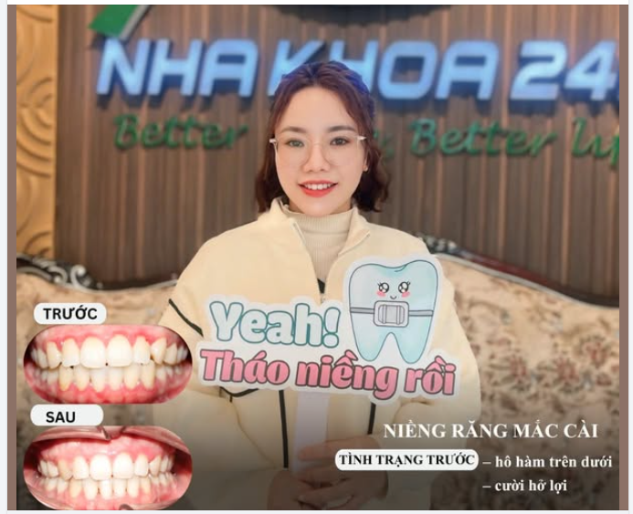 YEAH! THÁO NIỀNG RỒI  Hành trình niềng răng của bạn Hương Ly đã chính thức về đích!