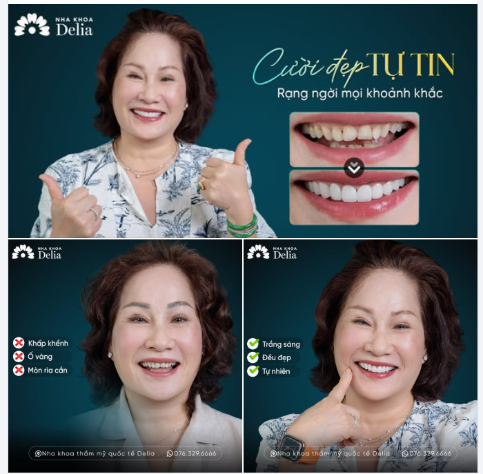 U70 LÀM RĂNG SỨ ĐỂ SỐNG VUI - SỐNG KHỎE - SỐNG CÓ ÍCH