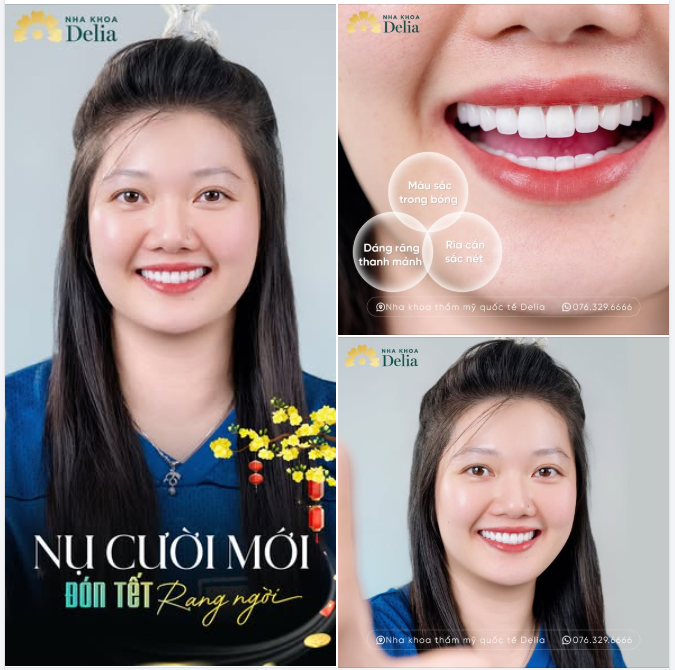 SẮC XUÂN CHẠM KHẼ NỤ CƯỜI DELIA